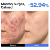 ABC Triple-synergy Redness Comfort Serum