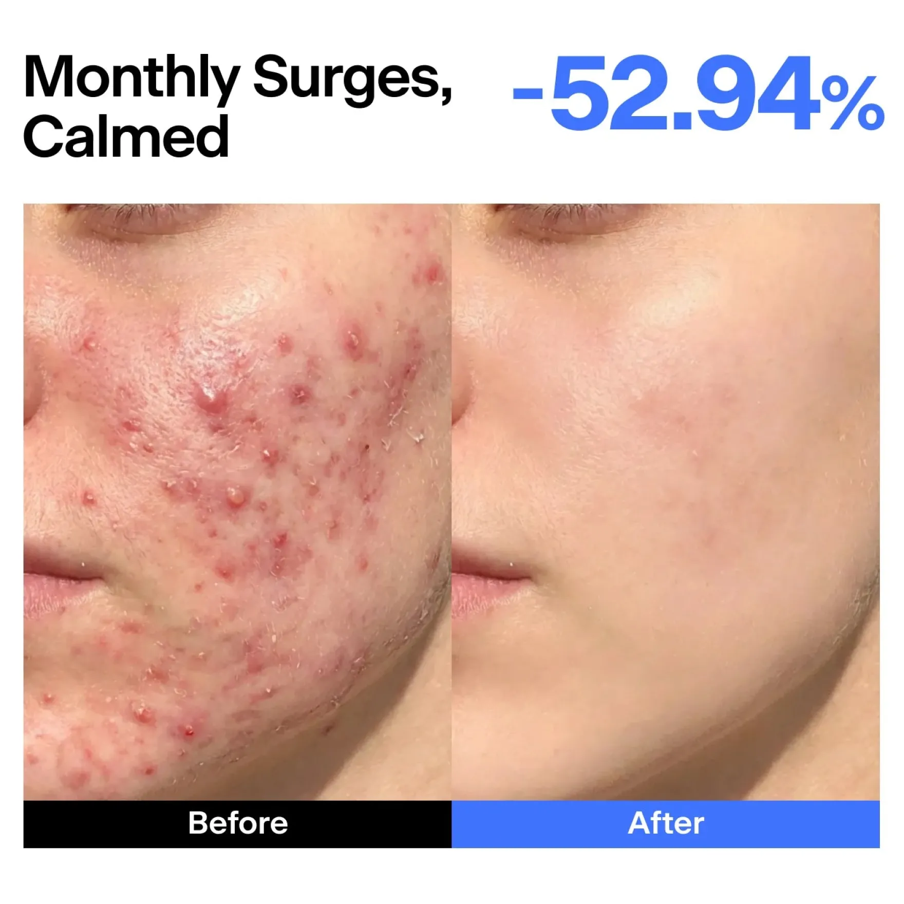 ABC Triple-synergy Redness Comfort Serum