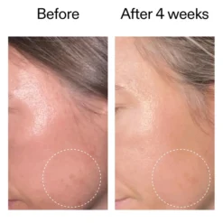 Advanced Retinoid Serum