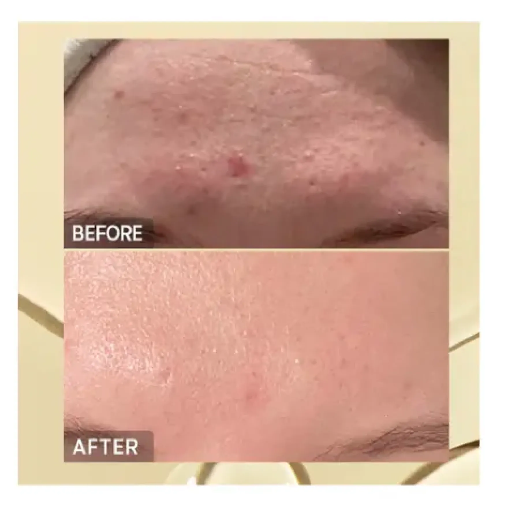 Advanced Snail96 Mucin Power Essence