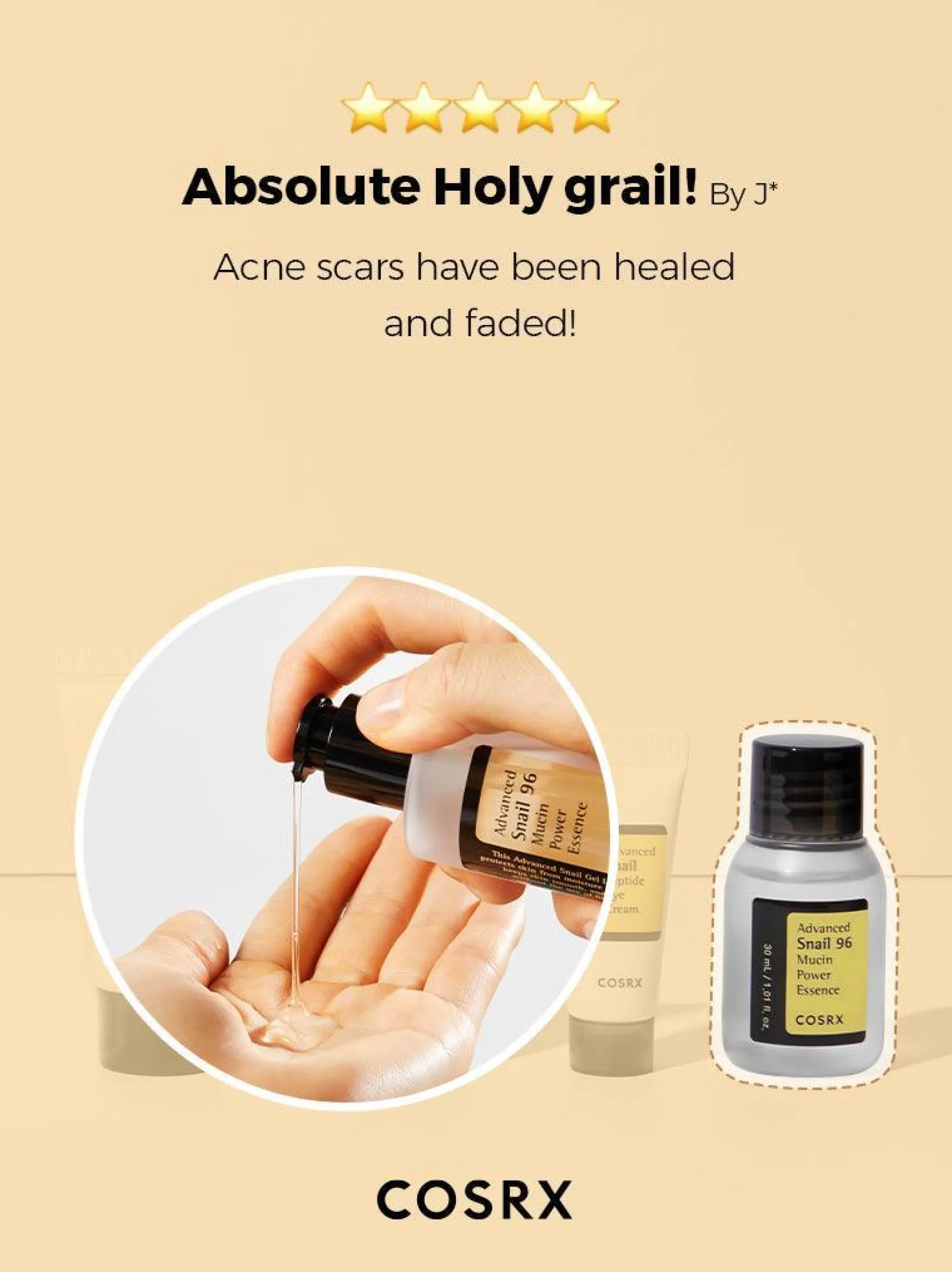 All About Advanced Snail Kit