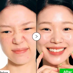 Aloe PDRN Calming Serum