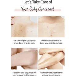 Anti-blemish Body Lotion