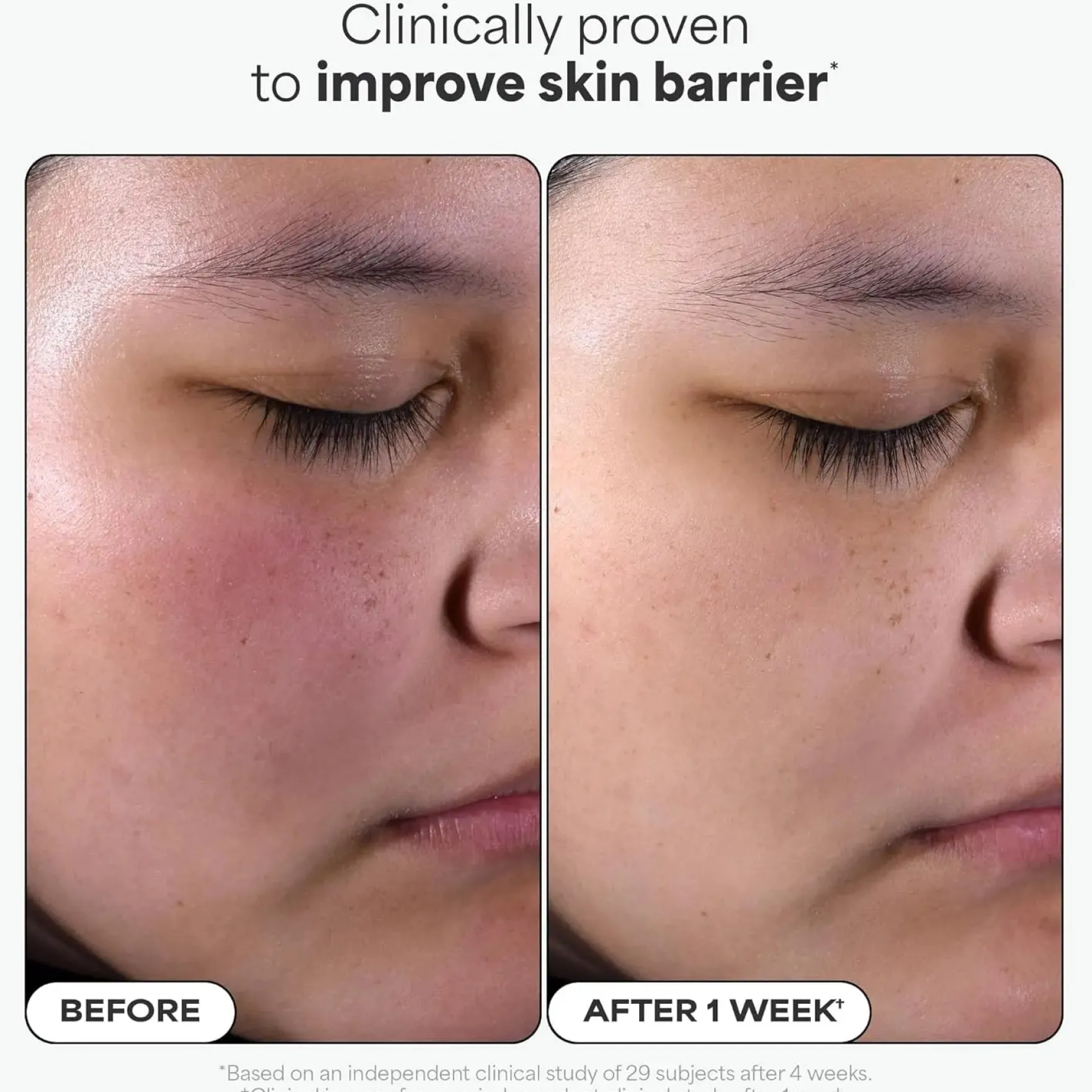 BHA Liquid Exfoliant 30 ml.