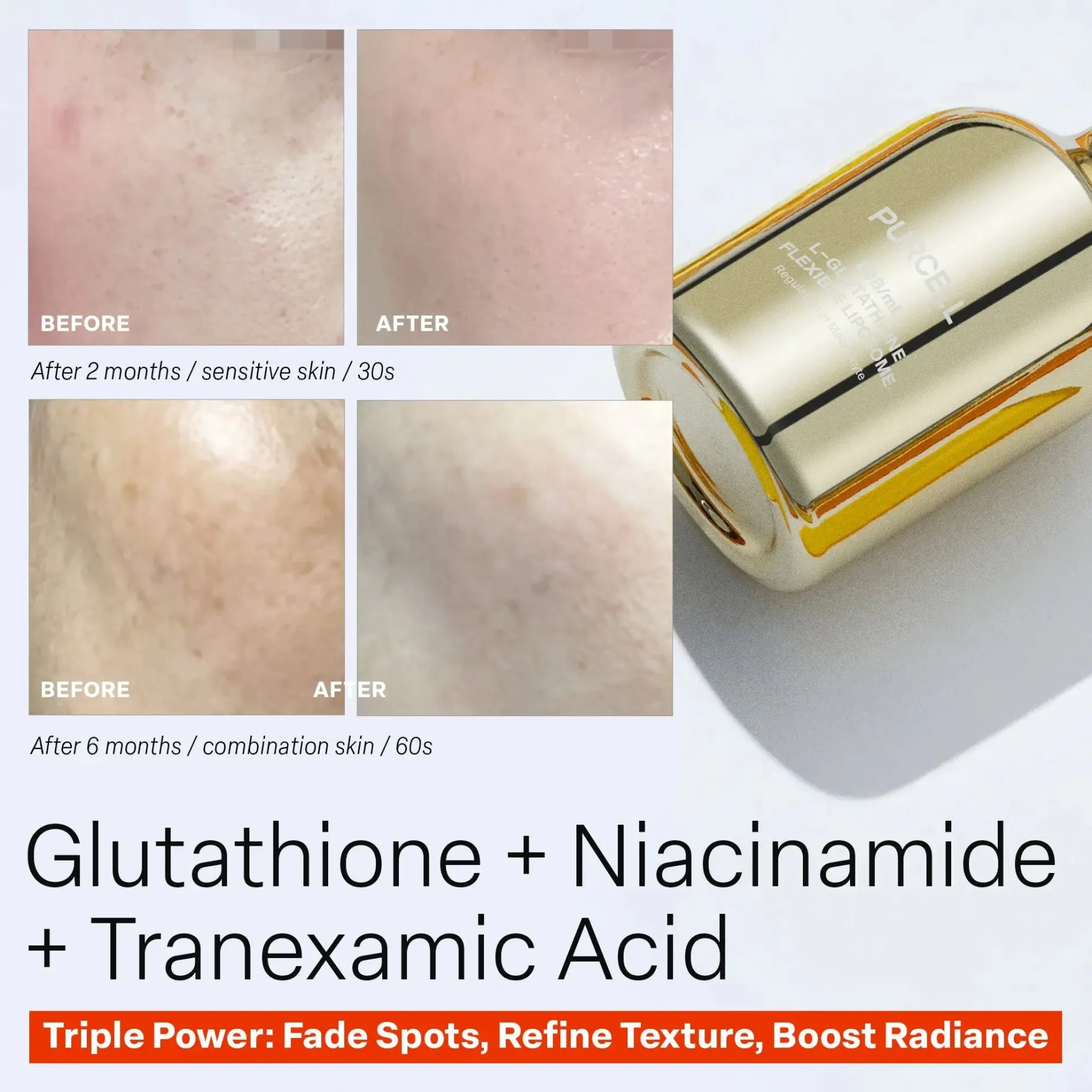 88b/ml L-glutathione Flexible Liposome