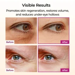 Cemenrete Calcium Volume Multi Balm