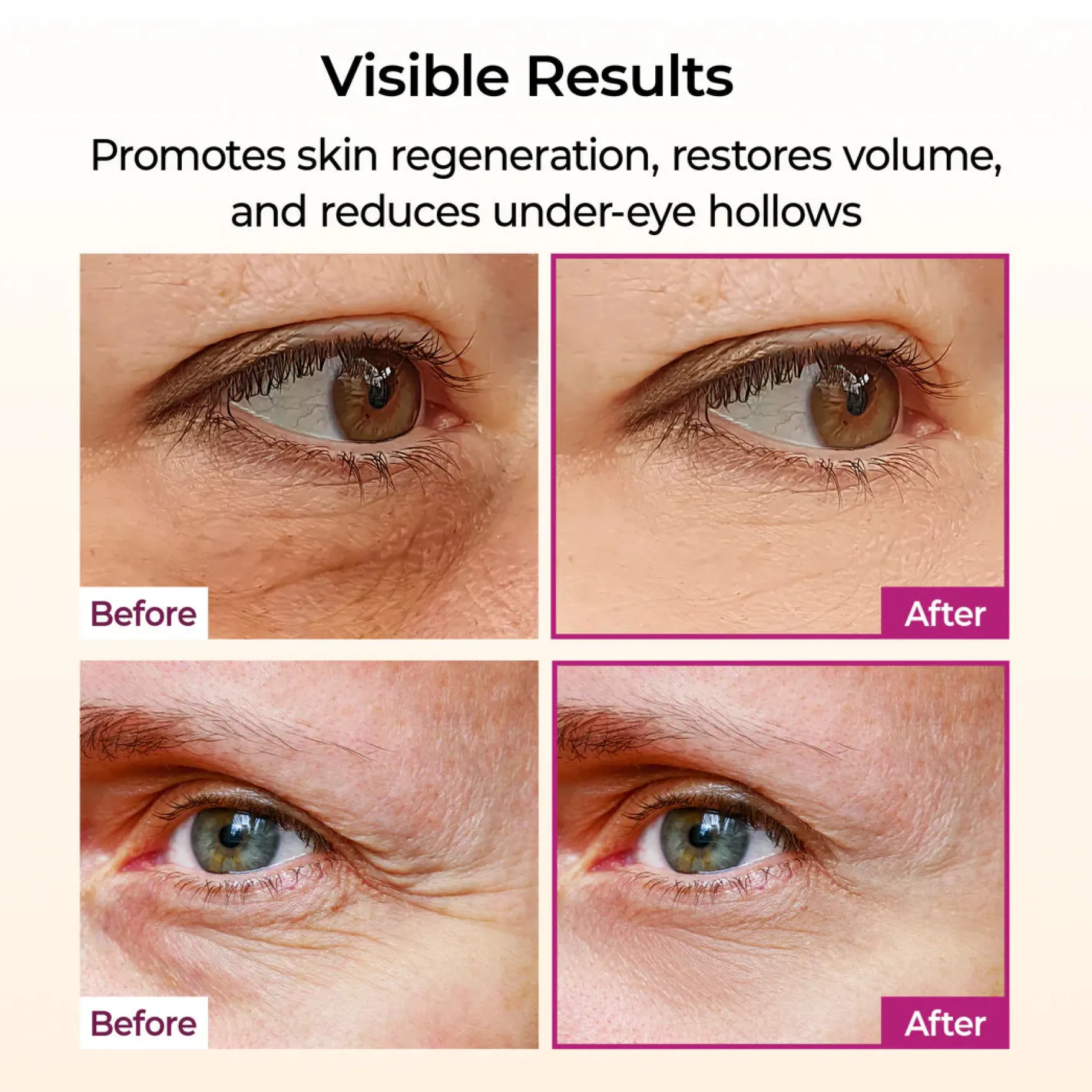 Cemenrete Calcium Volume Multi Balm