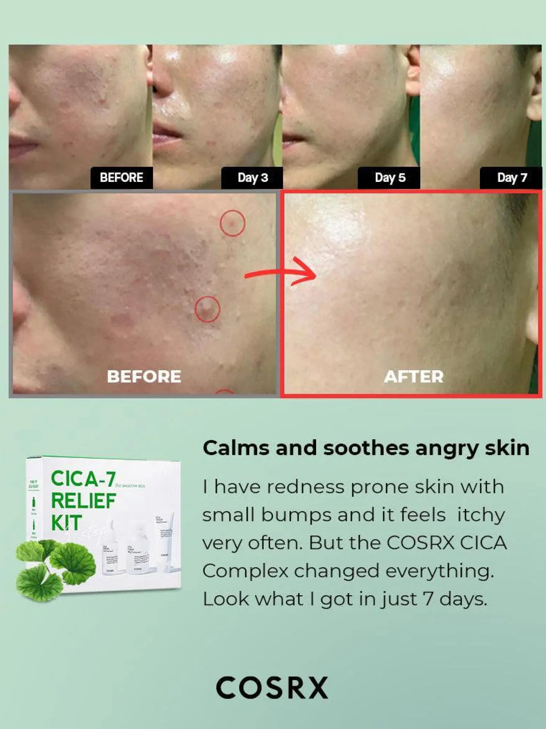 CICA-7 Relief Kit