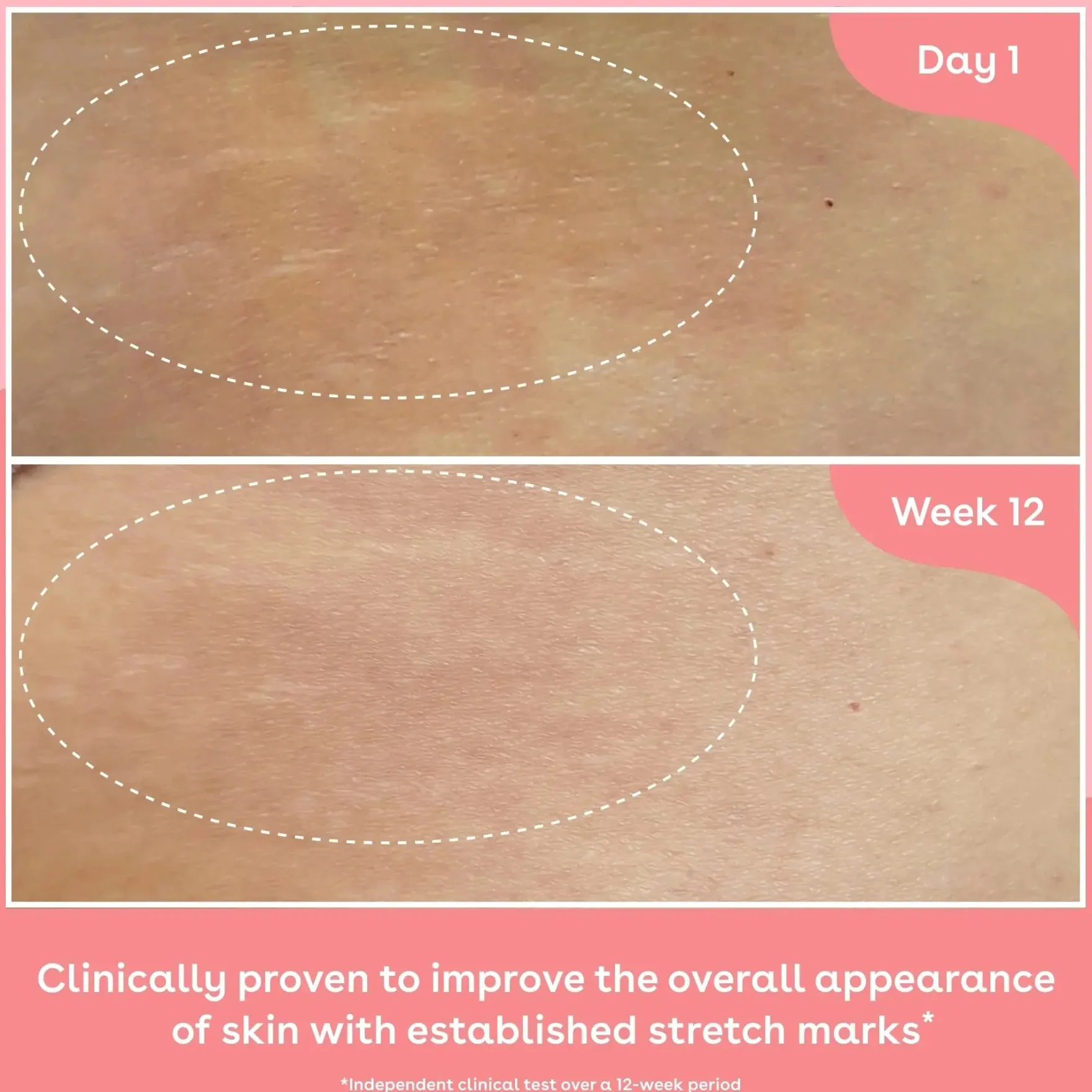 Collagen Body Oil