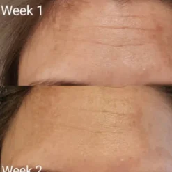 Collagen Tripeptide & Vitamine C