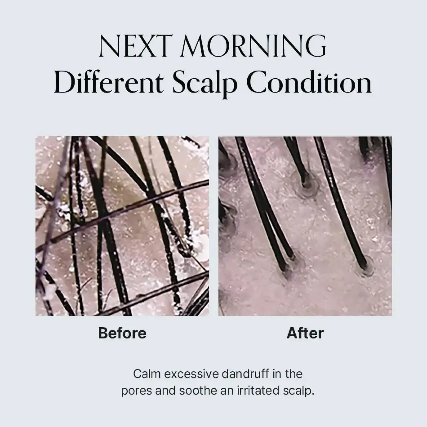 Damage Therapy Scalp Scaling Ampoule