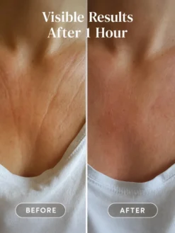 Décolleté Pad Hyaluron