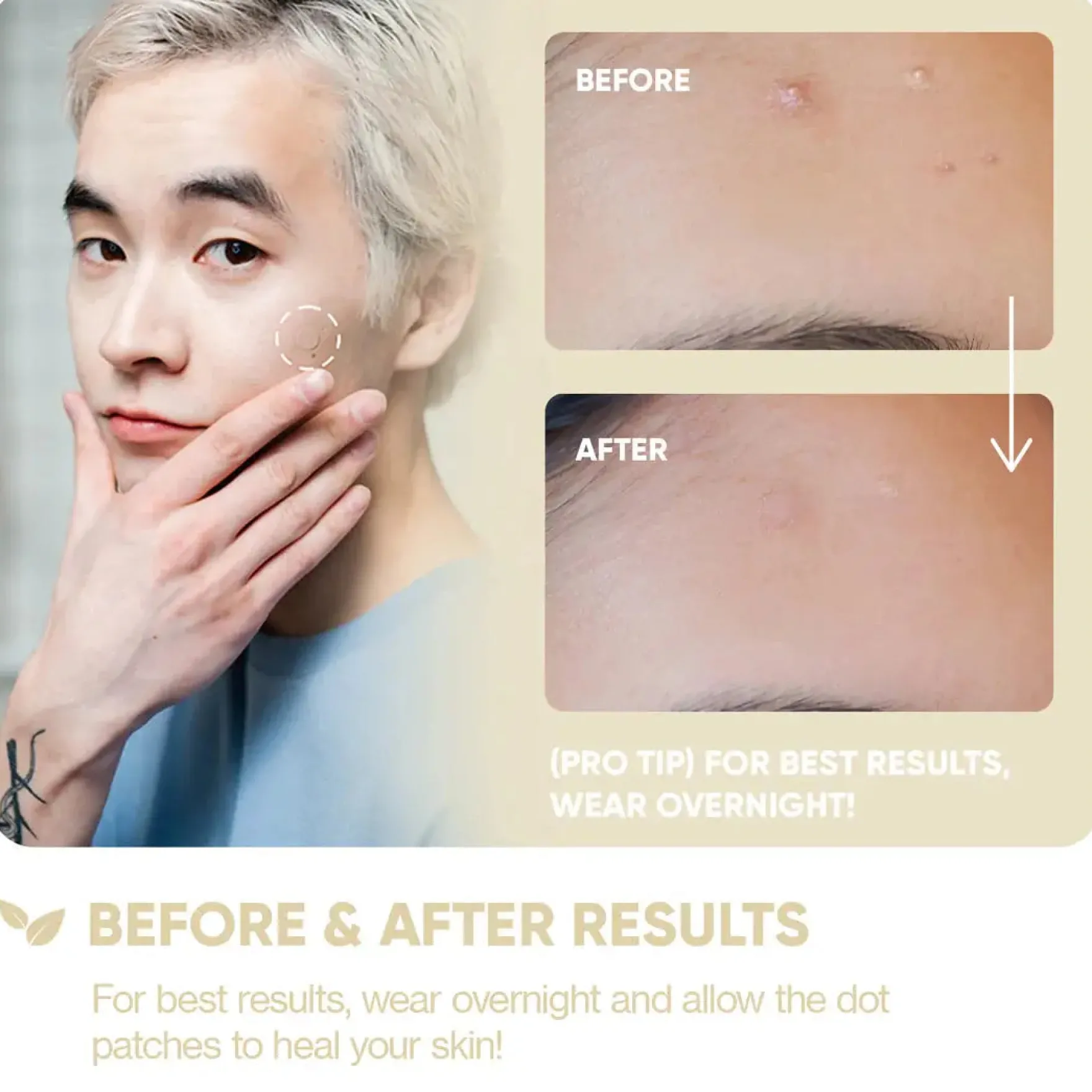 Emergency Dots For Spots Niacinamide and Zinc