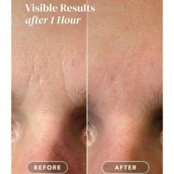 Facial Patches Hyaluron