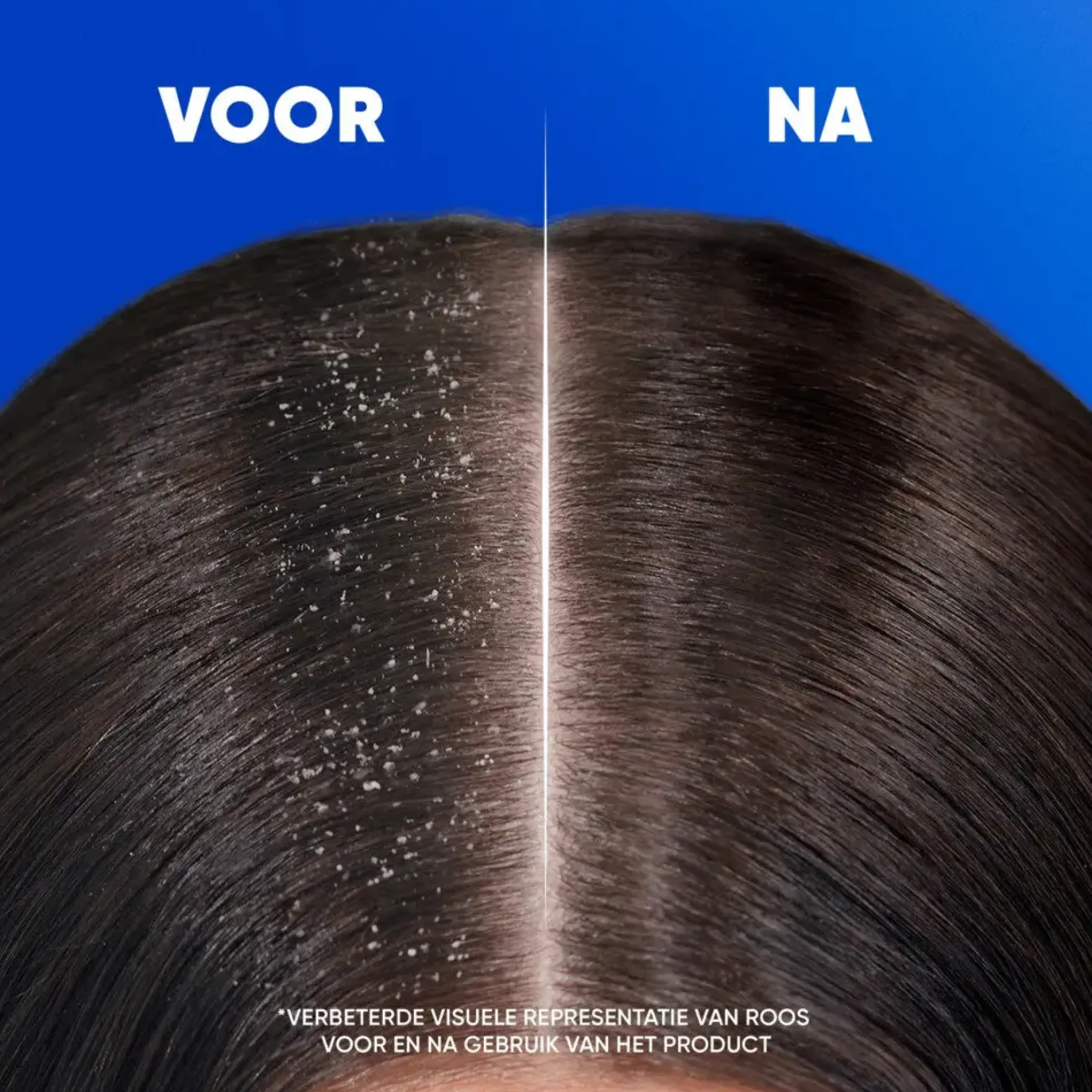 Intense Hydration Shampoo