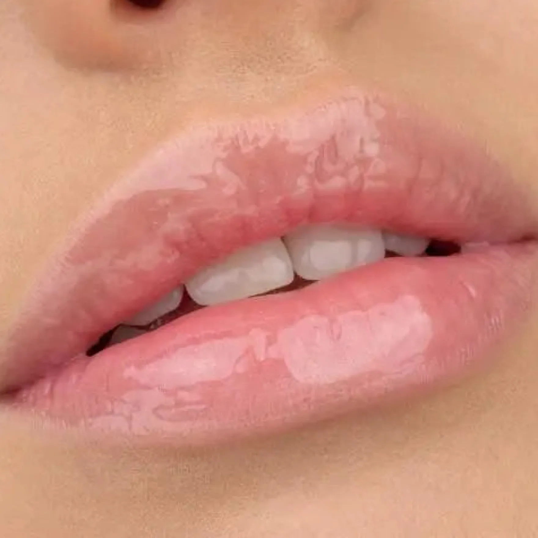 Juicy Bomb Shiny Lipgloss 101 Lovely Litchi