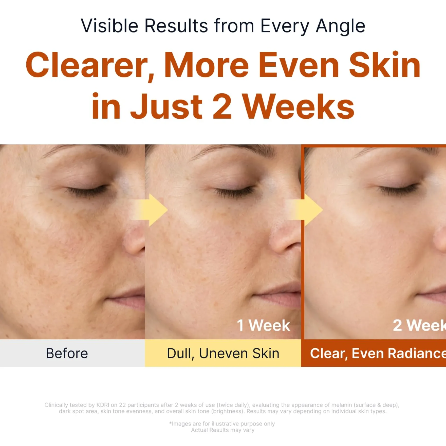 Kojic Acid Niacinamide Brightening Ampoule