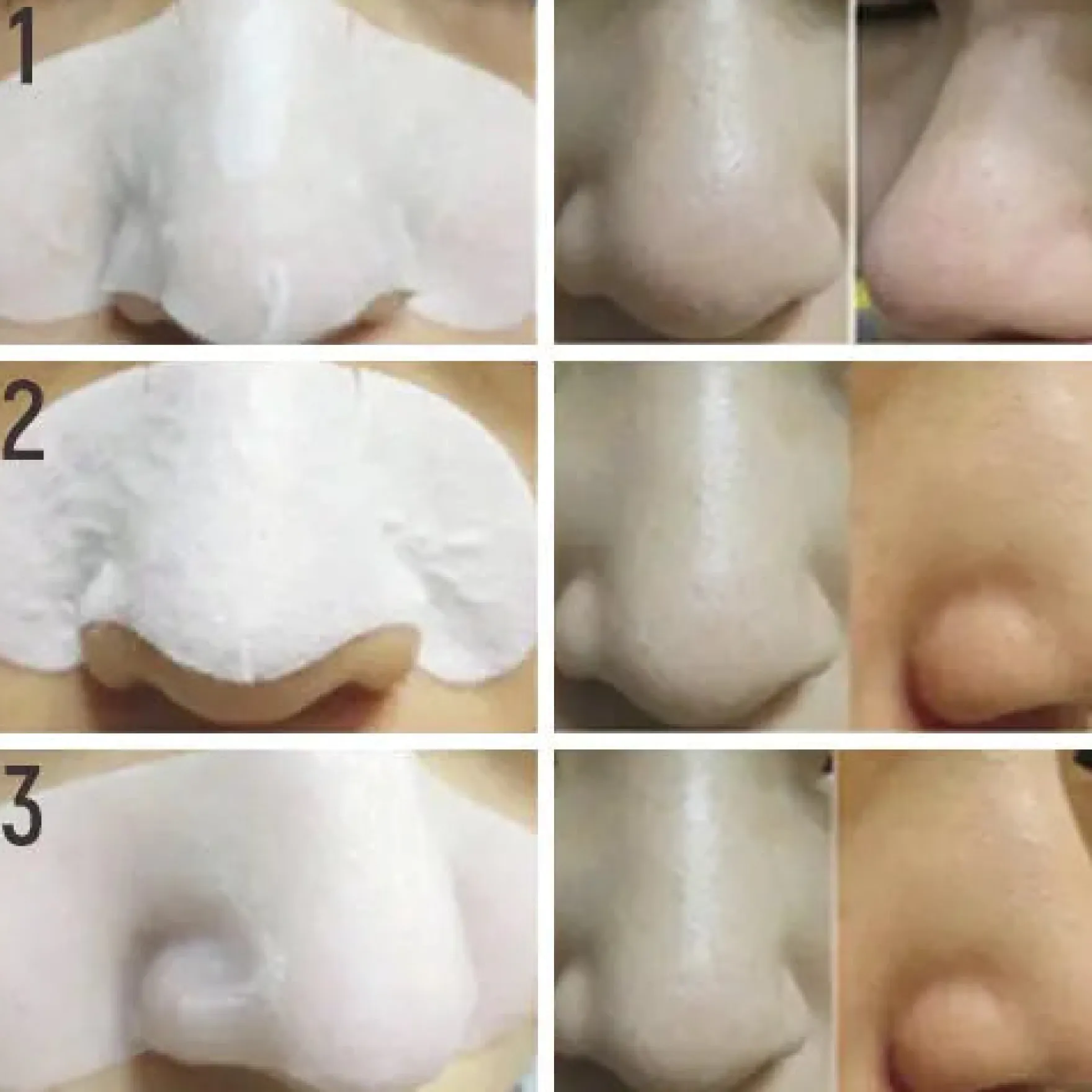 Milky Piggy Black Head 3 Step Solution