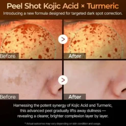 Peel Shot Exfoliating Kojic Acid Turmeric Serum