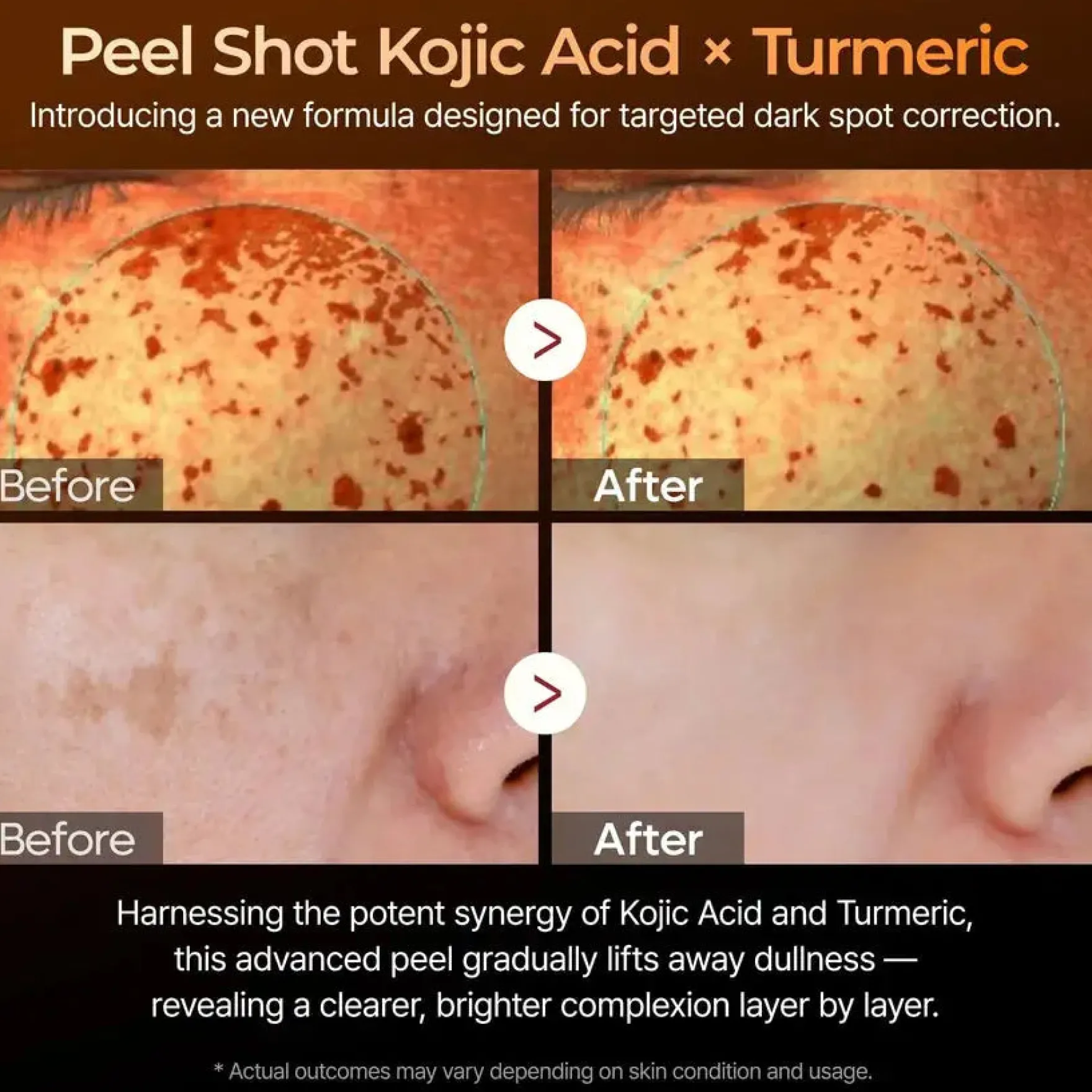 Peel Shot Exfoliating Kojic Acid Turmeric Serum