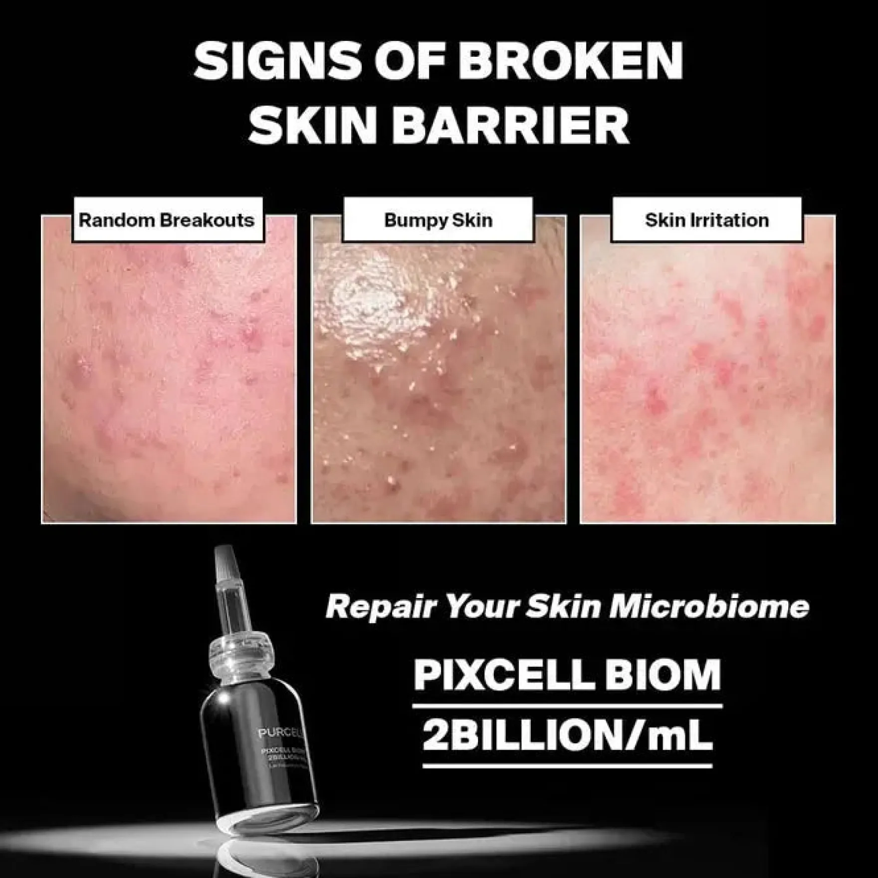 Pixcell Biom™ 2Billion