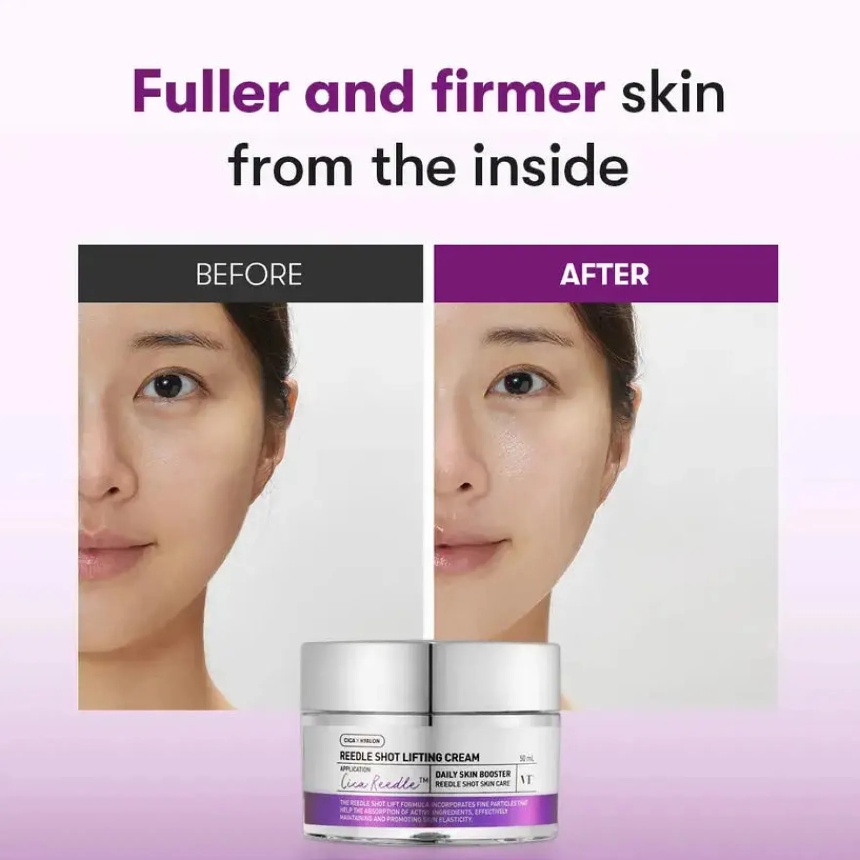Reedle Shot Lifting Cream
