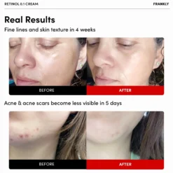 Retinol 0.1% Cream