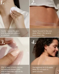 Scar Pads Aloe Vera