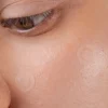 Spot the F Off Invisible Blemish Patches