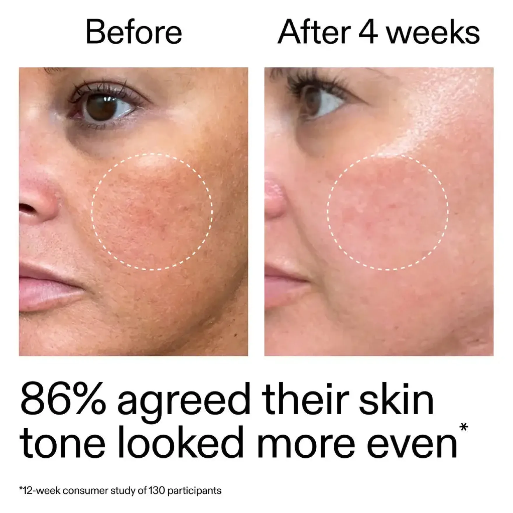 Starter Retinol Serum