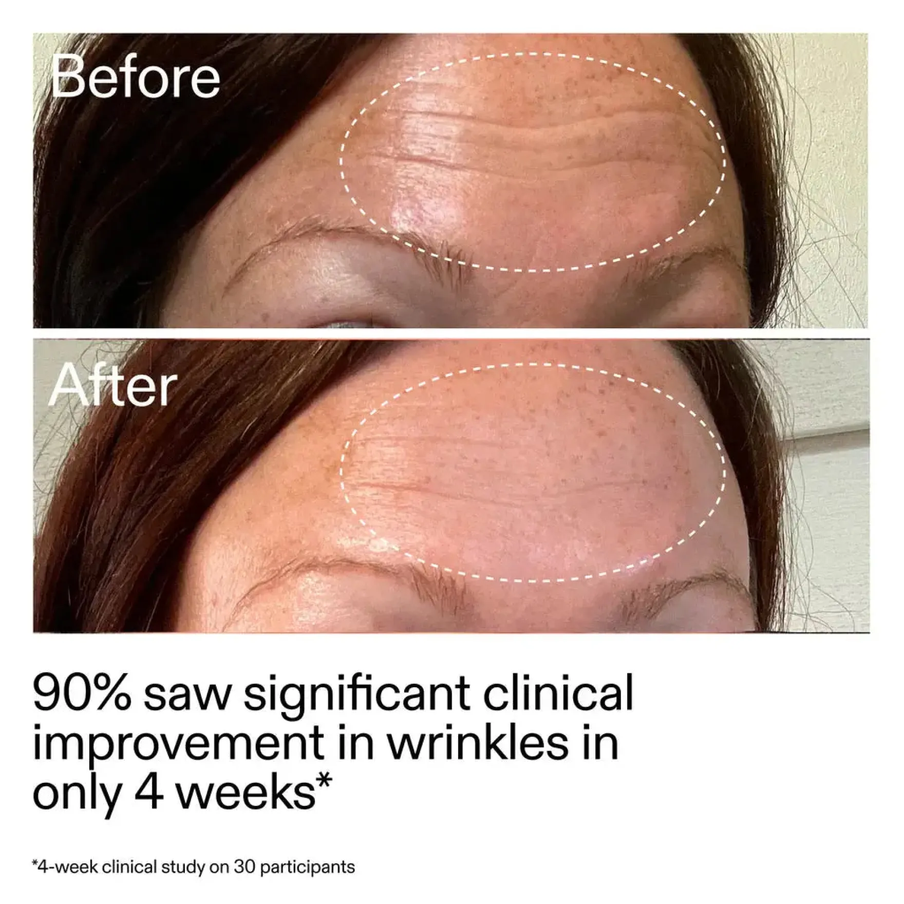 Starter Retinol Serum