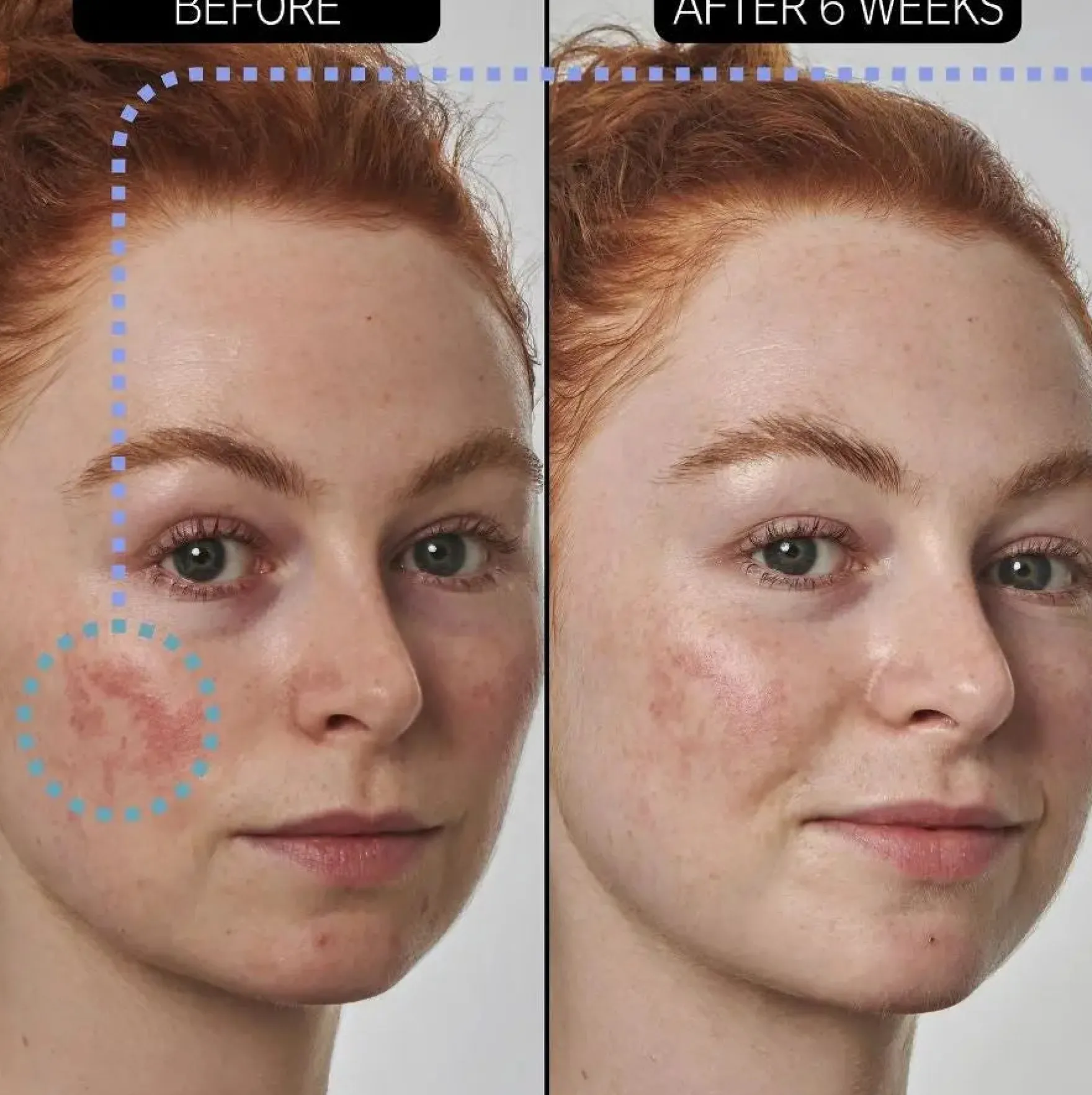 SuperSolutions Redness Relief Solution