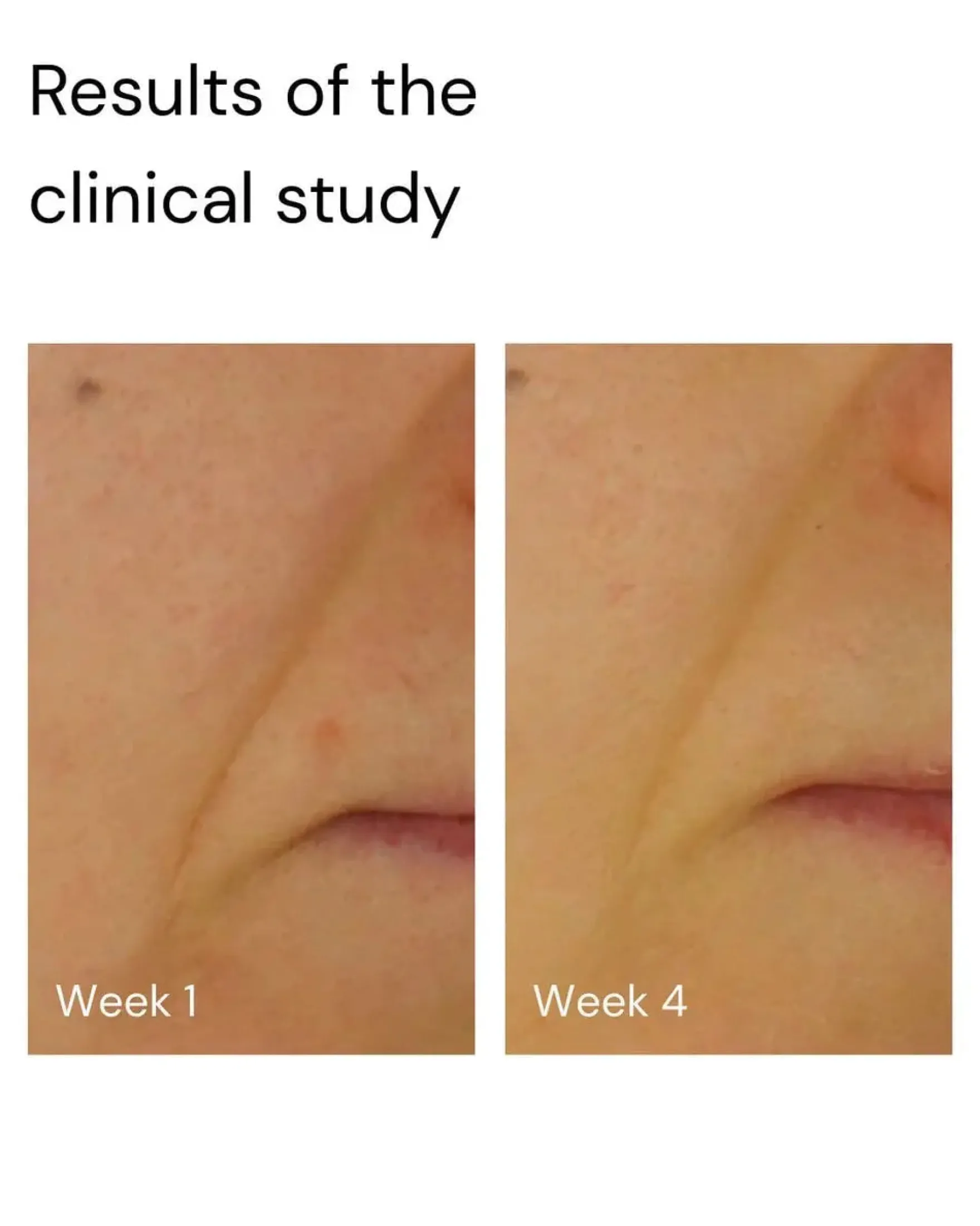 Super Stable C Face Serum 30 ml.