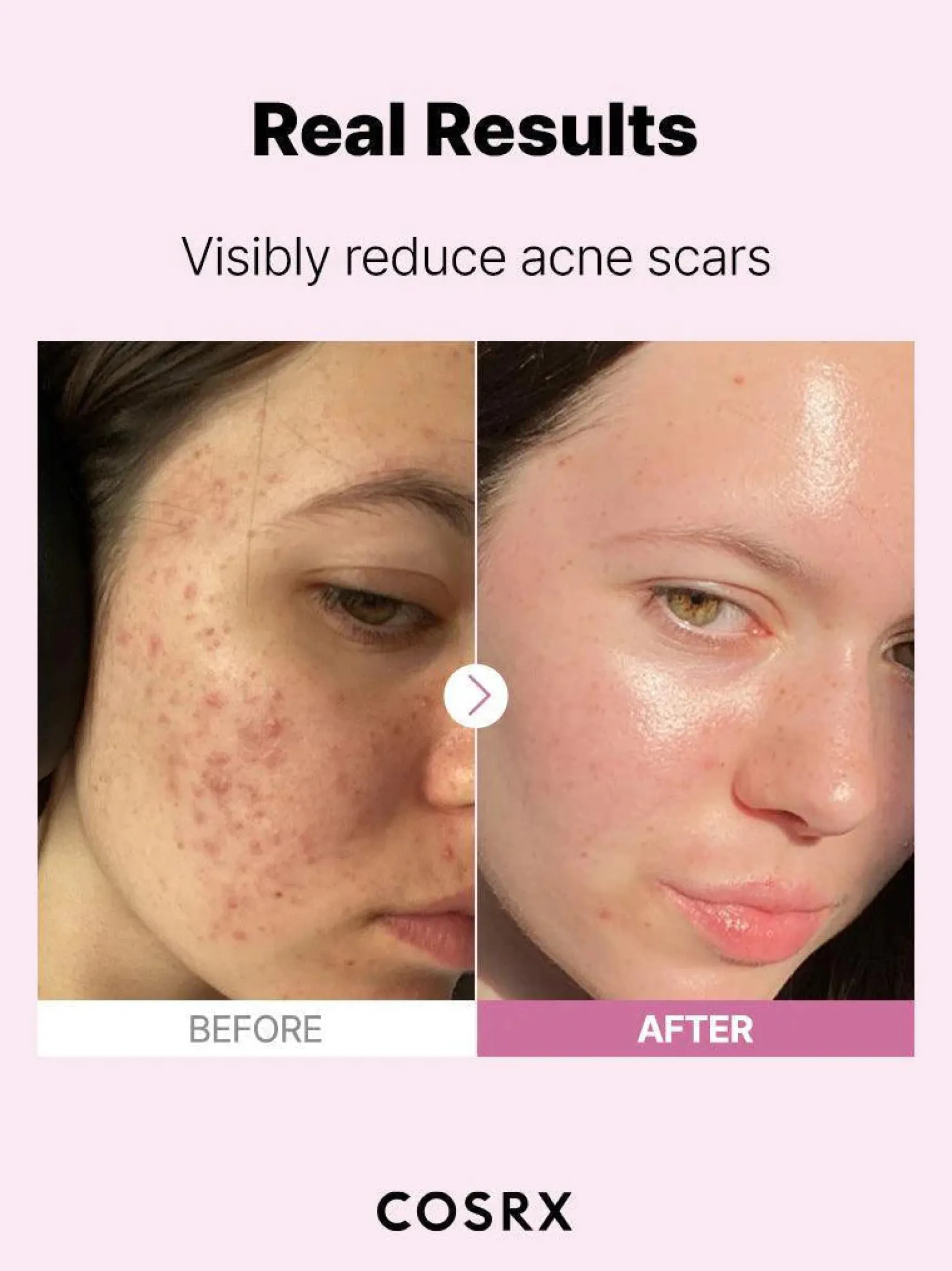 The Niacinamide 15 Serum