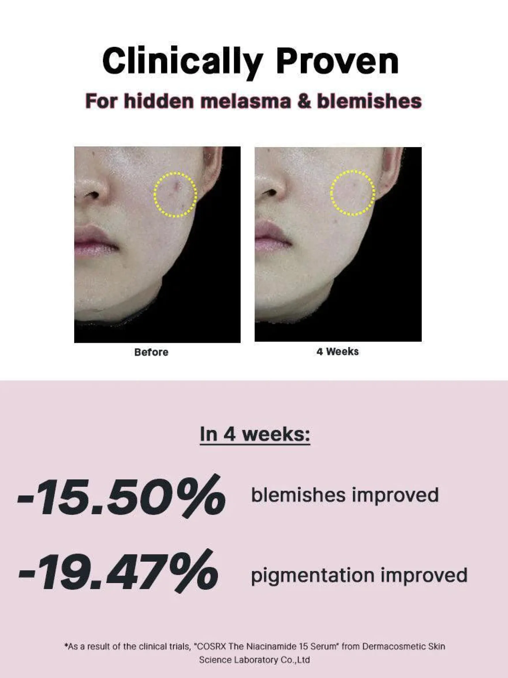 The Niacinamide 15 Serum