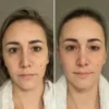 Tripeptide Collagen