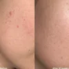 Triple AHA Cleanser
