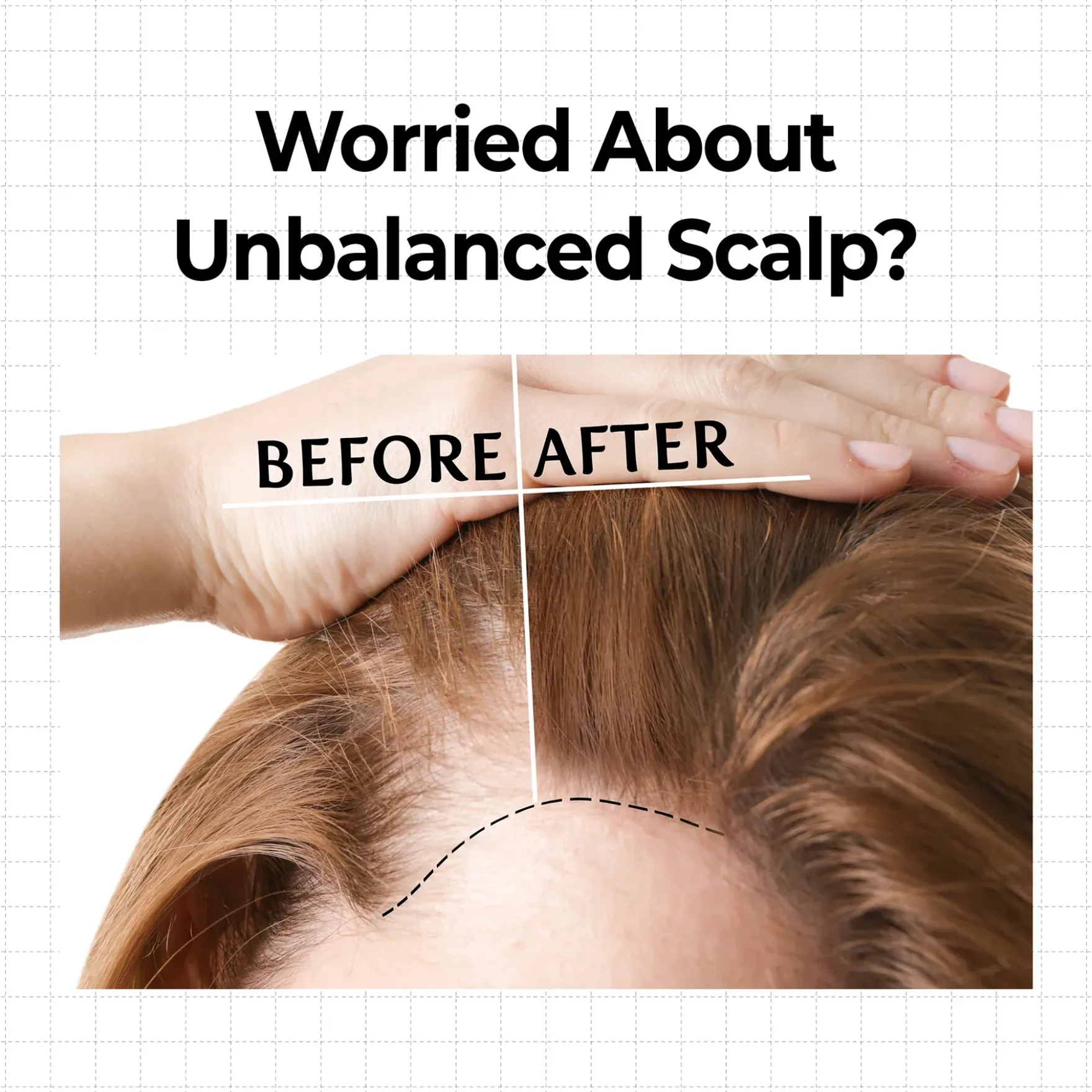 10x Caffeine Strengthening Scalp Serum