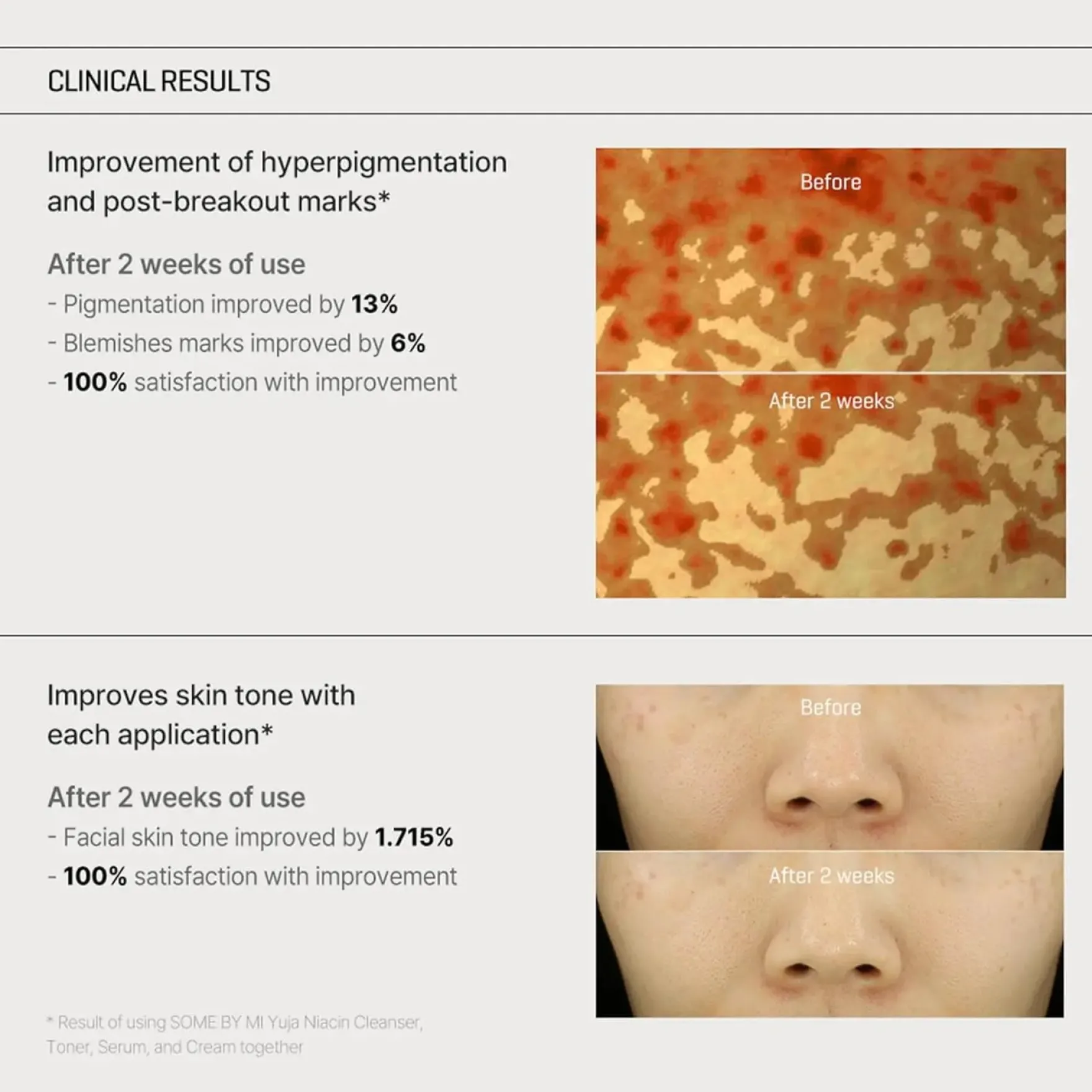 Yuja Niacin Anti-Blemish Cream