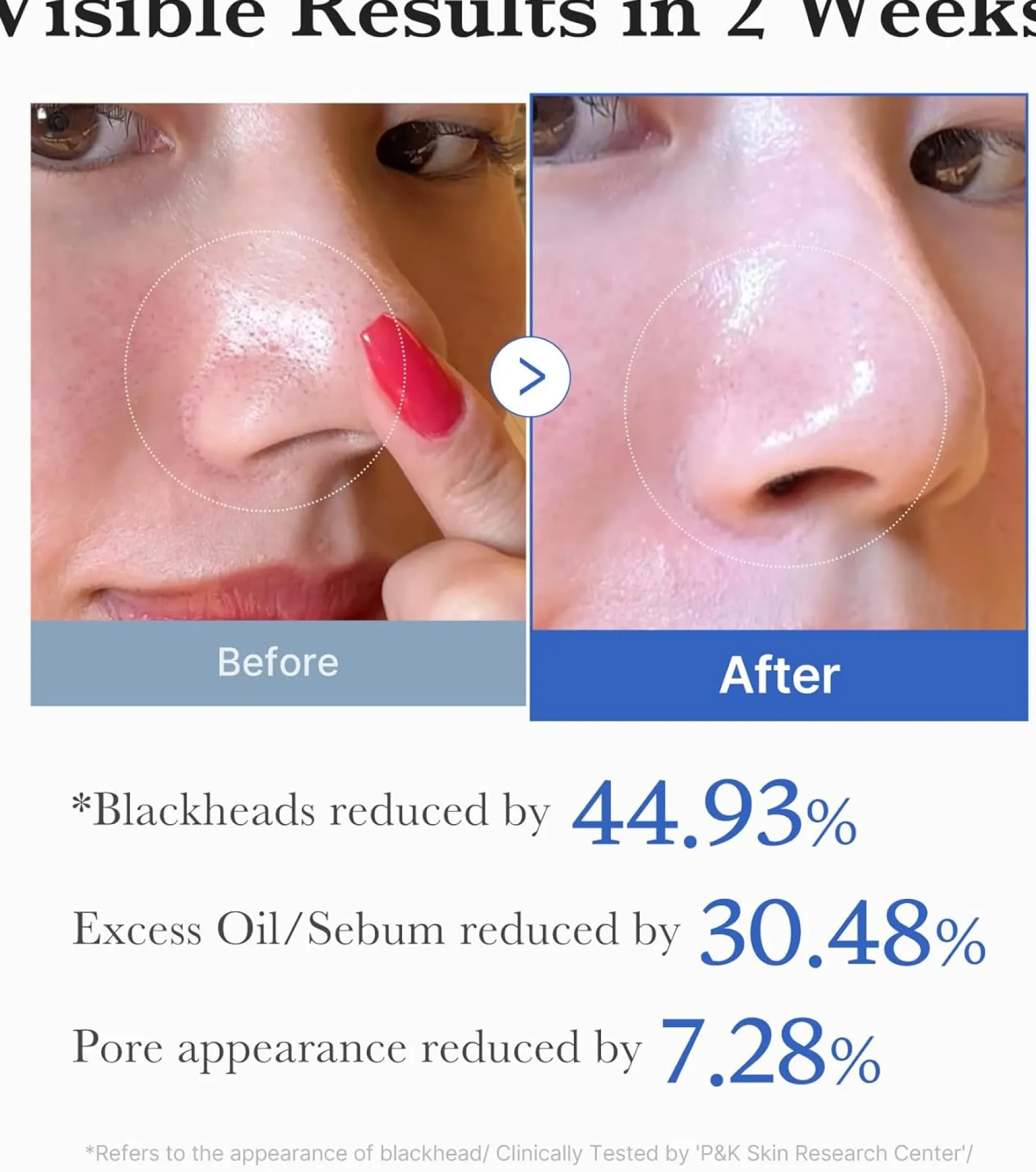 Zero Pore Pad 2.0
