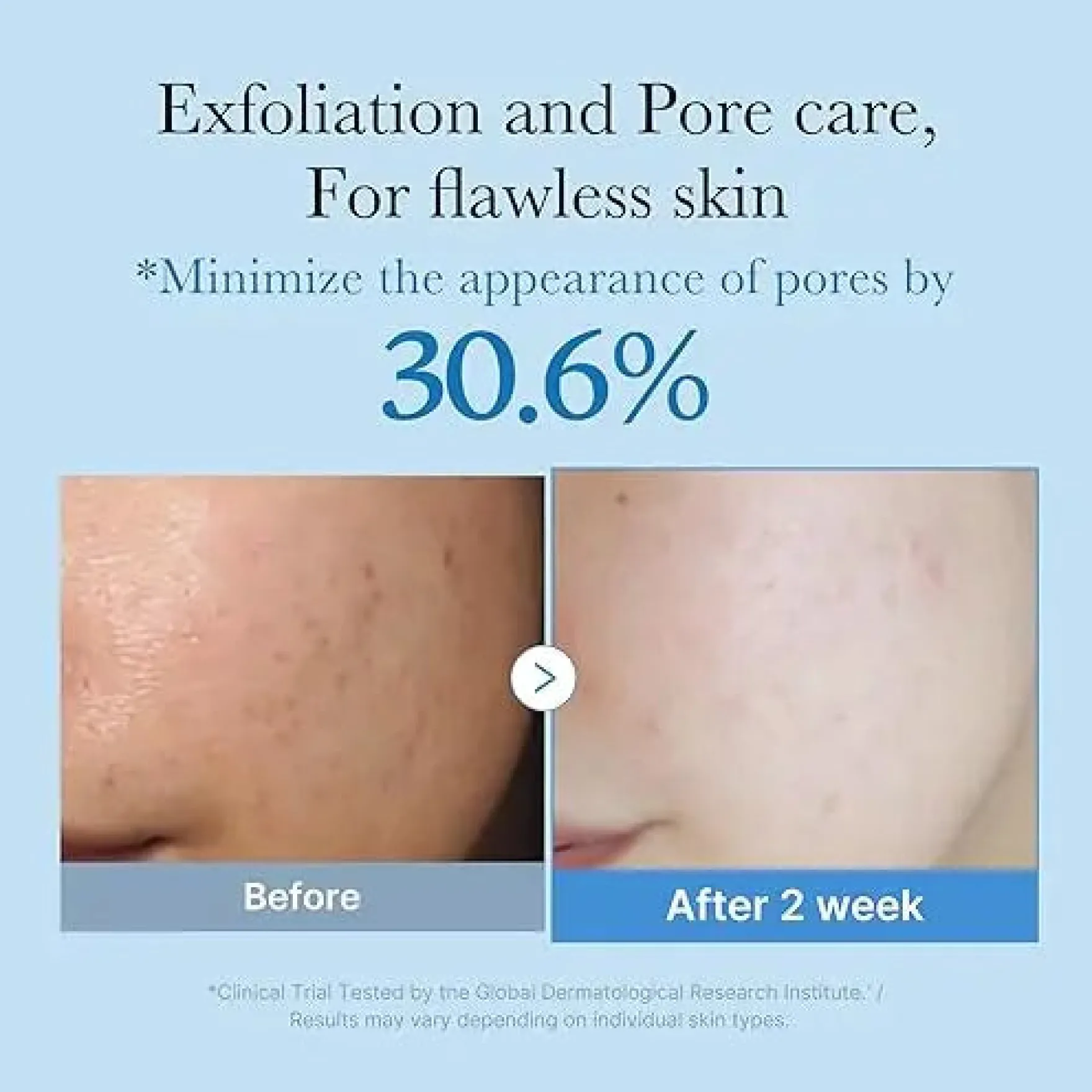 Zero Pore Toner